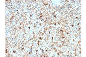 Formalin-fixed, paraffin-embedded human Cerebellum stained with GFAP Mouse Monoclonal Antibody (GFAP/2076). (GFAP Antikörper  (AA 101-200))