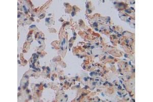 Used in DAB staining on fromalin fixed paraffin- embedded lung tissue (LARS Antikörper  (AA 260-509))