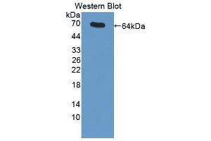 Western blot analysis of the recombinant protein. (MME Antikörper  (AA 455-750))