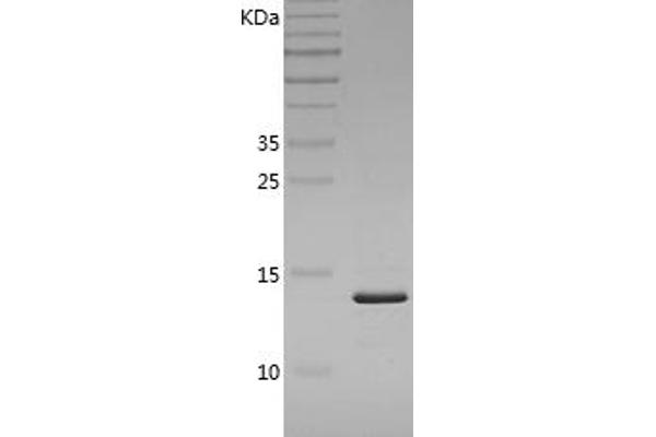 FABP4 Protein (AA 1-132) (His tag)