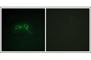 Immunofluorescence analysis of HepG2 cells, using NF1 Antibody. (Neurofibromin 1 Antikörper  (Internal Region))