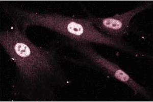 Immunofluroescence staining of Human Fibroblasts. (MEF2D Antikörper  (AA 346-511))