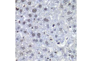 Immunohistochemistry of paraffin-embedded mouse liver using RBBP5 antibody at dilution of 1:100 (x40 lens). (RBBP5 Antikörper)