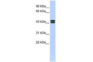 CACNB3 antibody used at 1 ug/ml to detect target protein. (CACNB3 Antikörper  (N-Term))