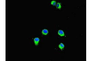 Immunofluorescent analysis of Hela cells using ABIN7160774 at dilution of 1:100 and Alexa Fluor 488-congugated AffiniPure Goat Anti-Rabbit IgG(H+L) (SMYD2A Antikörper  (AA 115-272))
