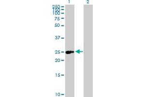 Western Blot analysis of ERAS expression in transfected 293T cell line by ERAS MaxPab polyclonal antibody. (ERAS Antikörper  (AA 1-233))