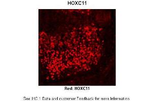 Immunohistochemistry (IHC) image for anti-Homeobox C11 (HOXC11) (Middle Region) antibody (ABIN2779771) (HOXC11 Antikörper  (Middle Region))