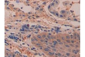 Immunohistochemistry (IHC) image for anti-Dimethylarginine Dimethylaminohydrolase 2 (DDAH2) (AA 31-265) antibody (ABIN7435682)