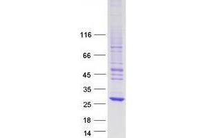 Validation with Western Blot