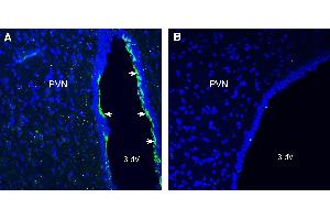 Expression CMKLR1 in rat paraventricular nucleus (PVN). (CMKLR1 Antikörper  (Extracellular))