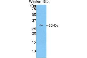 Western Blotting (WB) image for anti-Myosin IE (MYO1E) (AA 781-1036) antibody (ABIN1078393) (MYO1E Antikörper  (AA 781-1036))