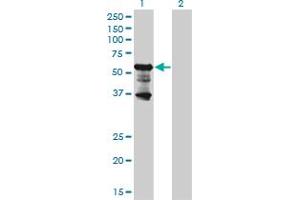 Western Blot analysis of PKNOX2 expression in transfected 293T cell line by PKNOX2 monoclonal antibody (M01), clone 4B6. (PKNOX2 Antikörper  (AA 116-215))