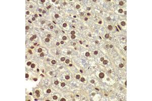 Immunohistochemistry of paraffin-embedded mouse liver using DDX5 antibody.