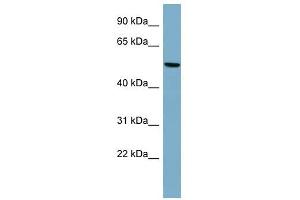PRPH antibody used at 1 ug/ml to detect target protein. (Peripherin Antikörper  (Middle Region))