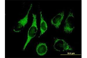 Immunofluorescence of purified MaxPab antibody to HADH2 on HeLa cell. (HSD17B10 Antikörper  (AA 1-261))