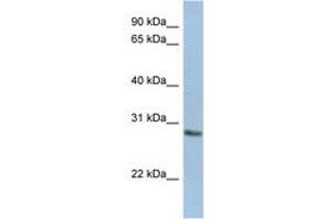 Image no. 1 for anti-N-Acetylneuraminic Acid Phosphatase (NANP) (AA 179-228) antibody (ABIN6743708) (NANP Antikörper  (AA 179-228))