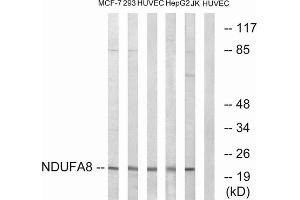 Western blot analysis of extracts from MCF-7 cells, 293 cells, HUVEC cells, HepG2 cells and Jurkat cells, using NDUFA8 antibody. (NDUFA8 Antikörper  (Internal Region))