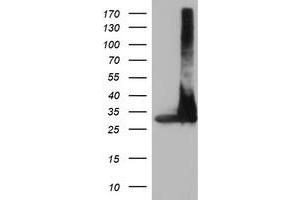 Western Blotting (WB) image for anti-Proteasome Subunit alpha 4 (PSMA4) antibody (ABIN1500458)