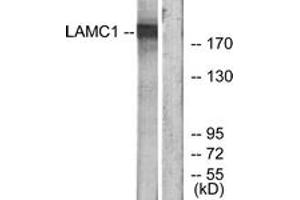 Western blot analysis of extracts from HuvEc cells, using LAMC1 Antibody. (Laminin gamma 1 Antikörper  (AA 1451-1500))