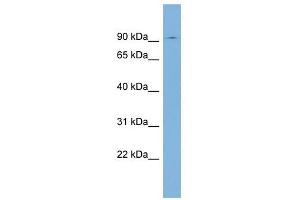 SEC63 antibody used at 1 ug/ml to detect target protein. (SEC63 Antikörper)
