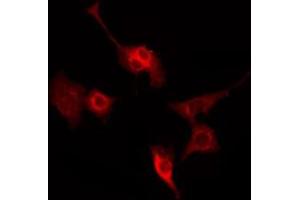 ABIN6269172 staining HeLa by IF/ICC. (SYN1 Antikörper  (N-Term))