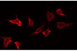 ABIN6272403 staining NIH-3T3 by IF/ICC. (PTPRN2 Antikörper  (Internal Region))