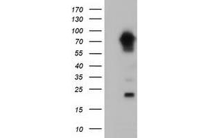 Western Blotting (WB) image for anti-Myotubularin Related Protein 14 (MTMR14) antibody (ABIN1499586) (MTMR14 Antikörper)