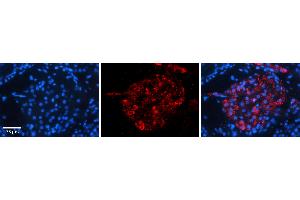 Rabbit Anti-ERGIC3 Antibody   Formalin Fixed Paraffin Embedded Tissue: Human Testis Tissue Observed Staining: Cytoplasm in Leydig cells Primary Antibody Concentration: N/A Other Working Concentrations: 1:600 Secondary Antibody: Donkey anti-Rabbit-Cy3 Secondary Antibody Concentration: 1:200 Magnification: 20X Exposure Time: 0. (ERGIC3 Antikörper  (C-Term))