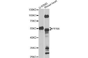 Western blot analysis of extracts of various cell lines, using PPAN Antibody (ABIN5975126) at 1/1000 dilution. (PPAN Antikörper)