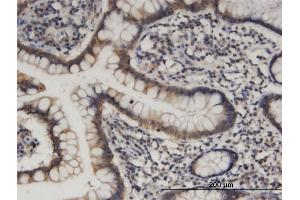 Immunostaining (ISt) image for anti-Hook Homolog 1 (HOOK1) (AA 632-728) antibody (ABIN526667)