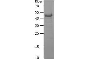 Western Blotting (WB) image for Integrin alpha 4 (ITGA4) (AA 790-1032) protein (His-IF2DI Tag) (ABIN7123466) (ITGA4 Protein (AA 790-1032) (His-IF2DI Tag))