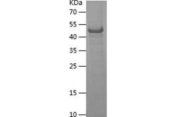 ITGA4 Protein (AA 790-1032) (His-IF2DI Tag)