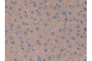 Detection of Hpt in Rat Liver Tissue using Polyclonal Antibody to Haptoglobin (Hpt) (Haptoglobin Antikörper  (AA 70-332))