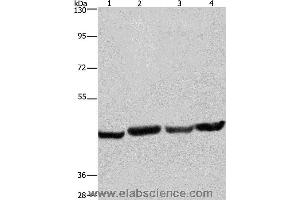 Western blot analysis of A549, Hela, PC3 and HepG2 cell, using RBMY1A1 Polyclonal Antibody at dilution of 1:360 (RBMY1A1 Antikörper)