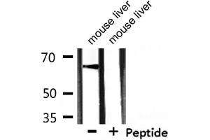 Western blot analysis of extracts from mouse liver, using GAD1 Antibody. (GAD Antikörper  (C-Term))