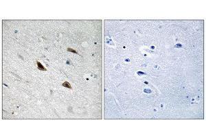 Immunohistochemistry (IHC) image for anti-Catenin, beta (CATNB) (pTyr489) antibody (ABIN1847545) (beta Catenin Antikörper  (pTyr489))