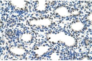Human Lung; ARIH2 antibody - N-terminal region in Human Lung cells using Immunohistochemistry