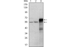 Western blot analysis using ETS1 mouse mAb against Jurkat (1), HepG2 (2) and ETS1-hIgGFc transfected HEK293 (3) cell lysate. (ETS1 Antikörper)