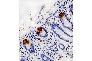 Immunohistochemical analysis of paraffin-embedded H. (LYZ Antikörper  (C-Term))