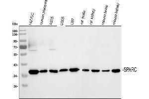 Western blot analysis of SPARC using anti-SPARC antibody (ABIN5518870).