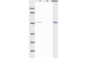 Lane 1: rat brain lysates Lane 2: human colon carcinoma lysates probed with Anti AVPR2 Polyclonal Antibody, Unconjugated (ABIN735398) at 1:200 in 4 °C. (MMP11 Antikörper  (AA 401-488))