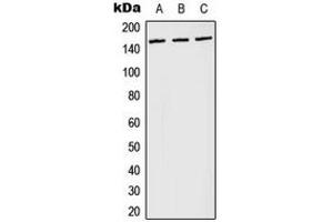 Western blot analysis of PLC gamma 1 (pY783) expression in Jurkat pervanadate-treated (A), NIH3T3 LPS-treated (B), PC12 H2O2-treated (C) whole cell lysates. (Phospholipase C gamma 1 Antikörper  (pTyr783))