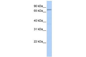 WB Suggested Anti-FBXO42 Antibody Titration:  0. (FBXO42 Antikörper  (Middle Region))