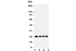 Western blot testing of FGF22 antibody and rat samples:  1. (FGF22 Antikörper  (Middle Region))