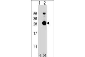 Western blot analysis of FKBP7 (arrow) using rabbit polyclonal FKBP7 Antibody (C-term) (ABIN656813 and ABIN2846027). (FKBP7 Antikörper  (C-Term))