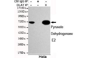 Immunoprecipitation analysis of Hela cell lysates using Pyruvate Dehydrogenase E2 mouse mAb. (CYB561 Antikörper)