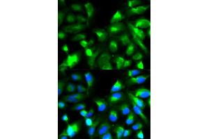 Immunofluorescence analysis of HeLa cell using SNAP25 antibody. (SNAP25 Antikörper  (AA 1-206))