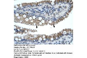 Human Intestine (ZNF683 Antikörper  (N-Term))