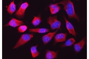 IF analysis of RPL32 using anti-RPL32 antibody (ABIN7602916). (RPL32 Antikörper  (C-Term))