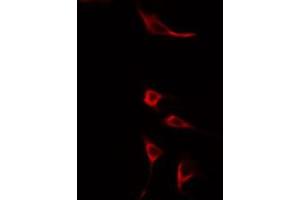 ABIN6275602 staining HuvEc cells by IF/ICC. (Sorting Nexin 4 Antikörper  (Internal Region))